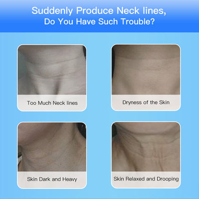 Therapy Skin Tighten Reduce Double Chin Face Lifting Devices
